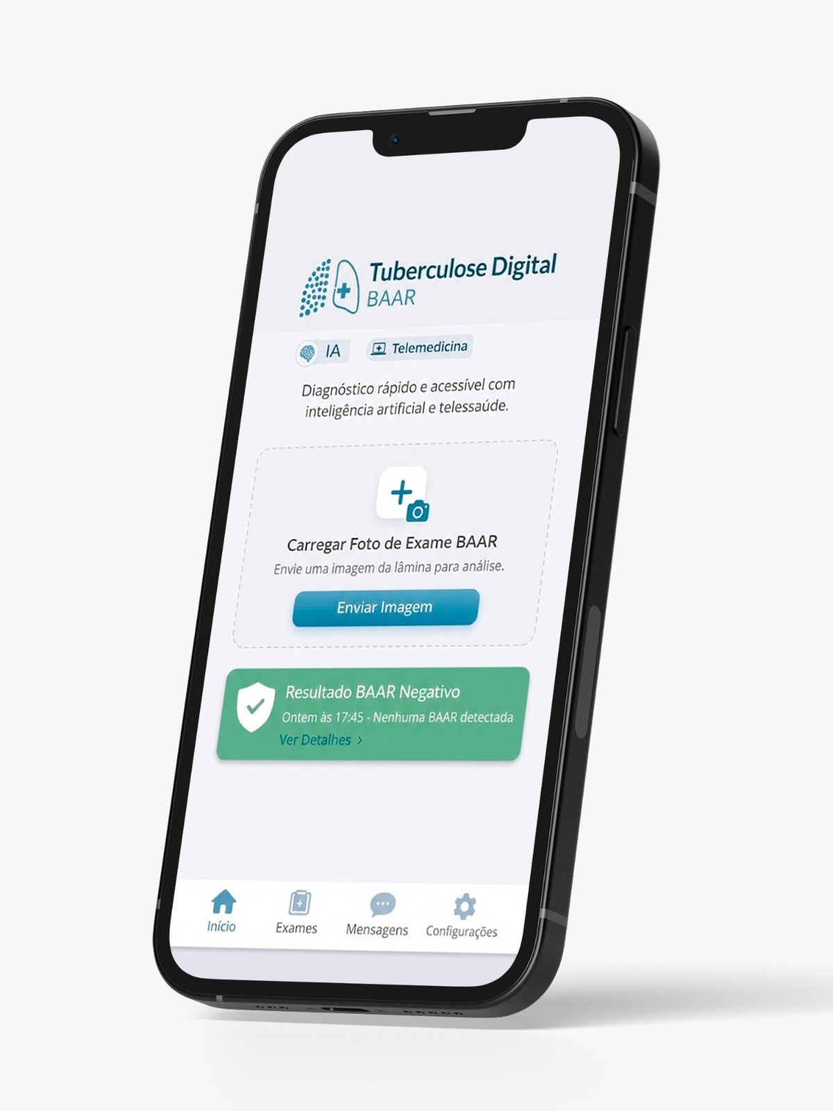 Tuberculose Digital BAAR